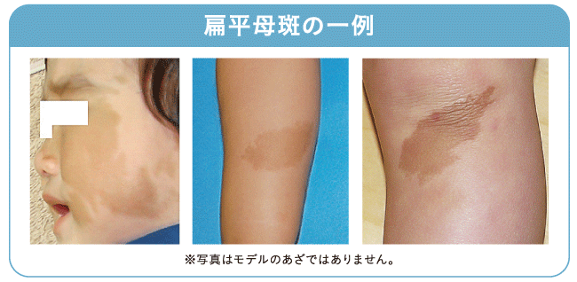 教えてドクター