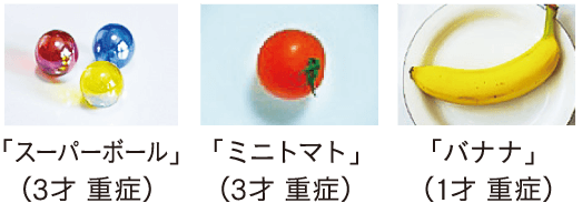 誤飲窒息