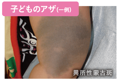 教えてドクター