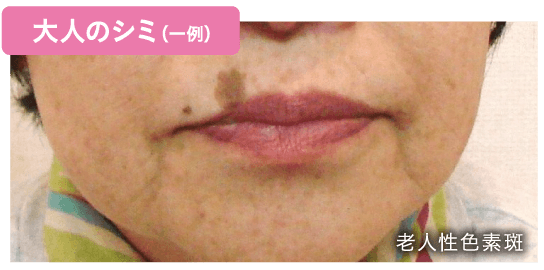 教えてドクター