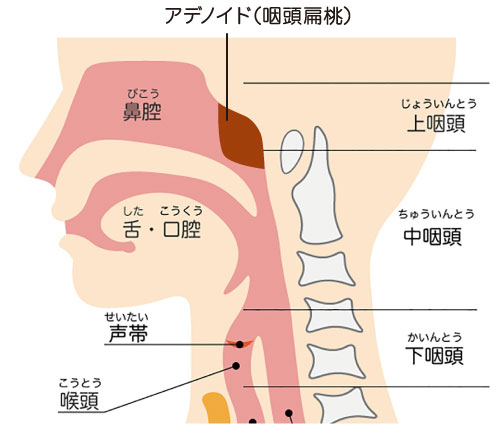 アデノイド