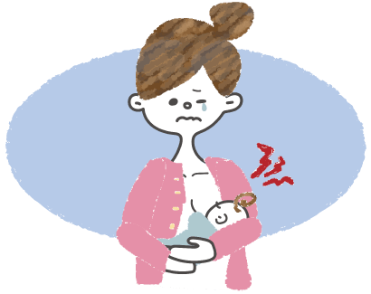 乳腺炎